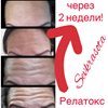Ботокс